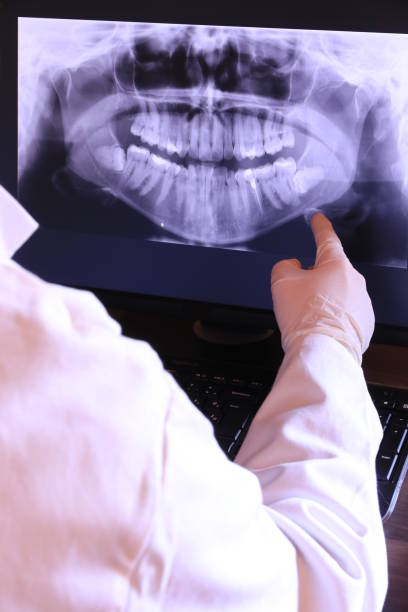 Best Emergency Tooth Extraction in East Franklin, NJ