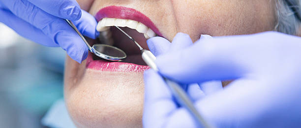 Best Emergency Dental Care for Broken or Chipped Teeth in East Franklin, NJ